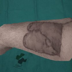 طبیعی سازی رنگ فلپ